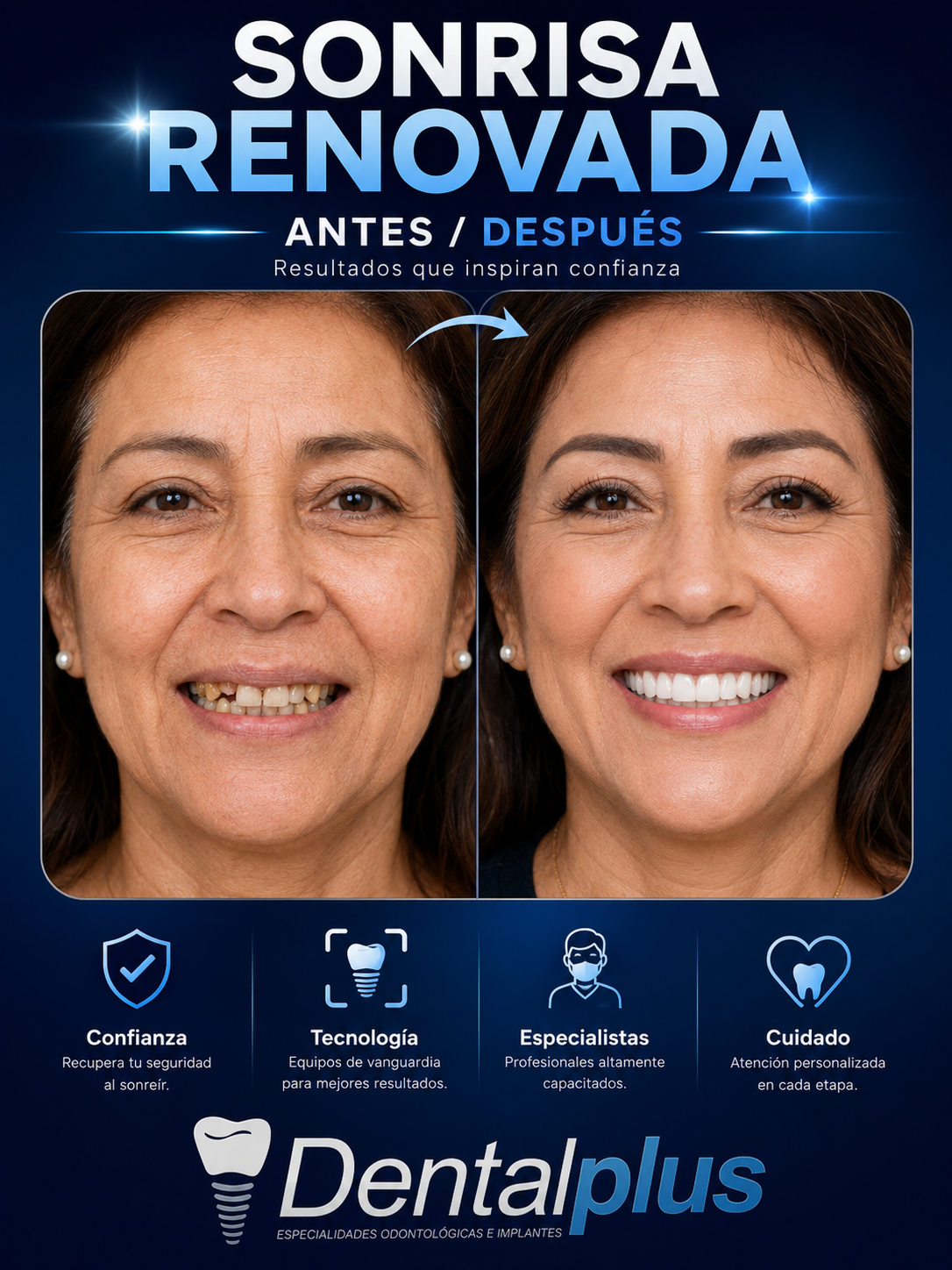 Sonrisa renovada — Dentalplus